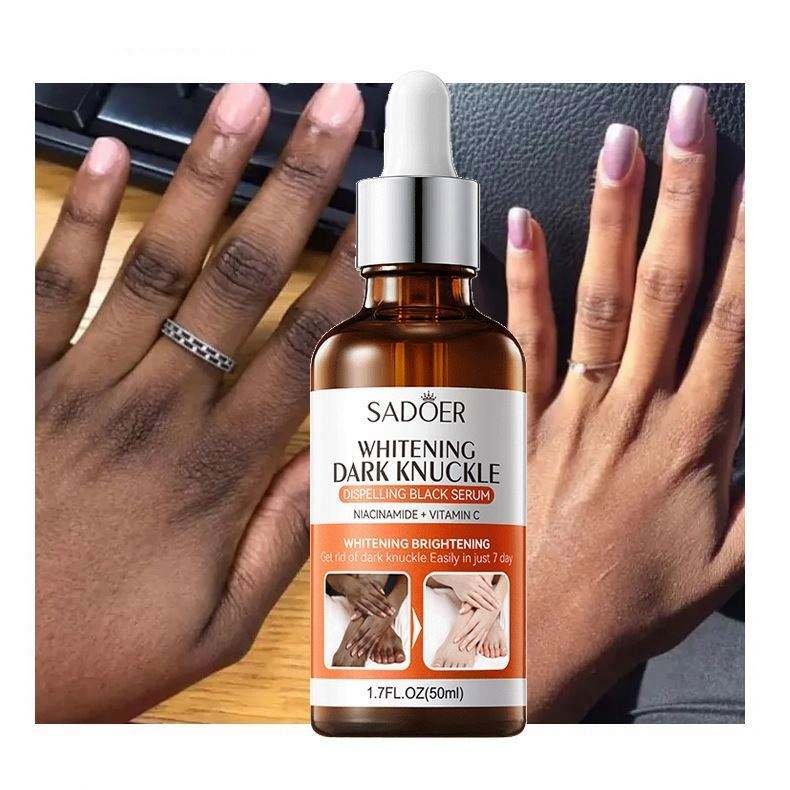 SADOER Joint Whitening and Dark Spot Removal Essence 50ml (1)